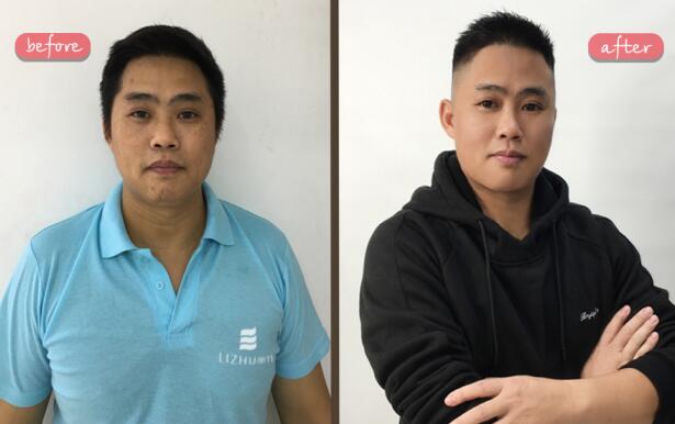 別讓發(fā)型毀了你那“盛世美顏”