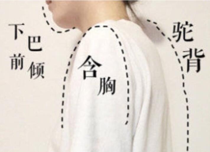 南寧美容學(xué)校：堅(jiān)持一個(gè)月，駝背變直背