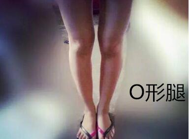 糾正你的腿型！
