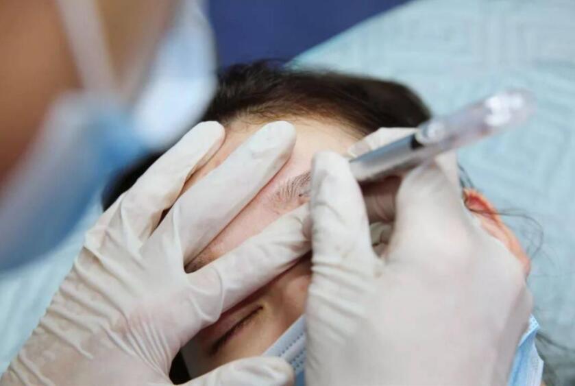 紋繡遇到容易出血的皮膚怎么辦？南寧專業(yè)紋繡培訓教你