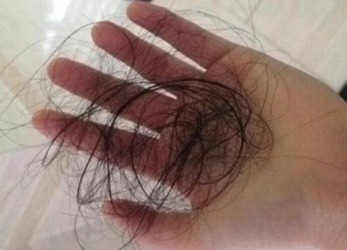 脫發(fā)女孩必備寶典！南寧美發(fā)學校教你