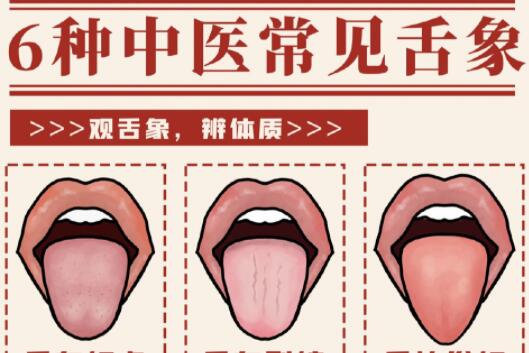 6種常見(jiàn)中醫(yī)舌診判定，快和廣西中醫(yī)美容一起學(xué)