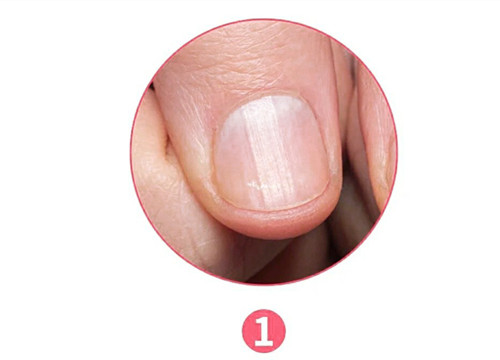 女生氣血不足六大表現(xiàn)，南寧美容養(yǎng)生資訊報(bào)道