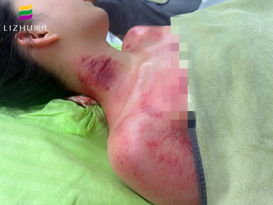 廣西學(xué)刮痧培訓(xùn)班 | 廣西學(xué)刮痧學(xué)費(fèi)多少？