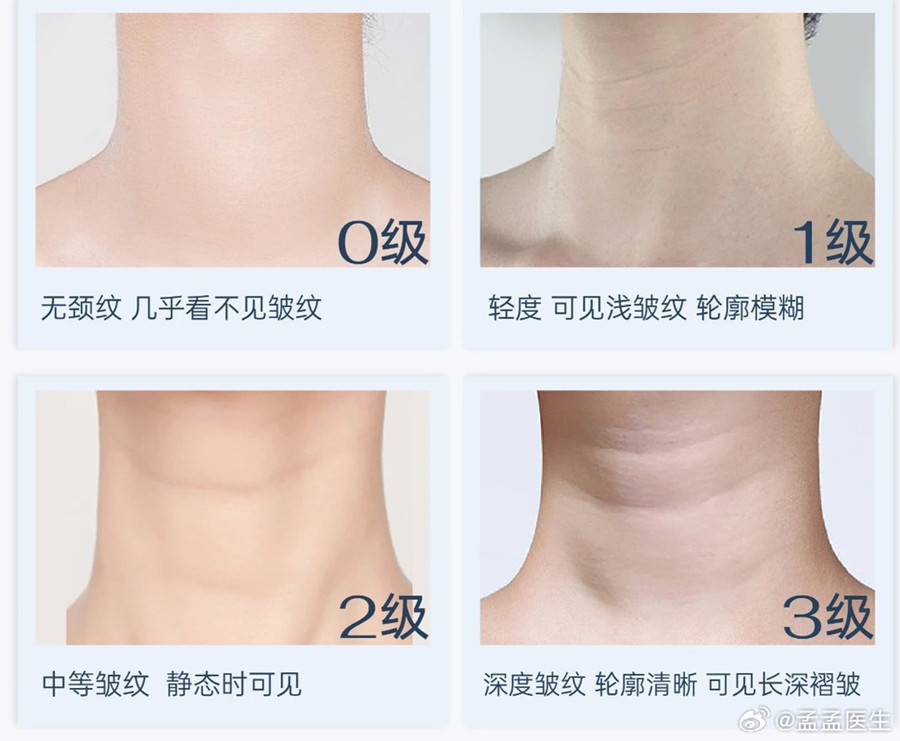 如何緩解頸紋？南寧美體美容管理培訓(xùn)