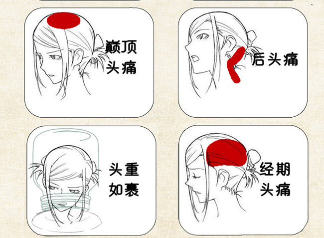 不同頭痛類型經(jīng)絡(luò)護(hù)理方法，廣西中醫(yī)美容培訓(xùn)
