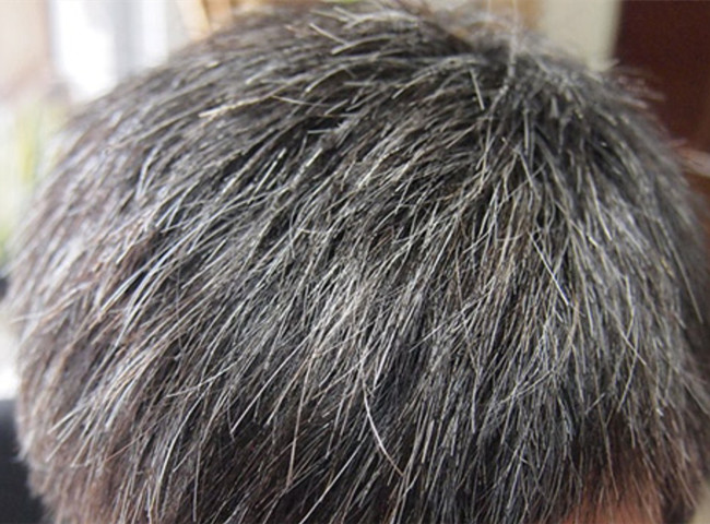 南寧美發(fā)基礎(chǔ)教學(xué)：為什么會長白頭發(fā)？