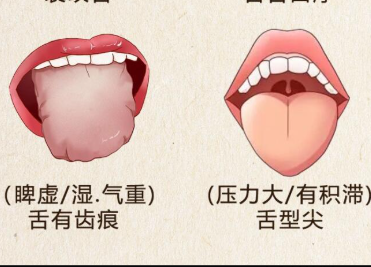 如何根據(jù)舌苔看健康 | 廣西美容美體培訓(xùn)哪里正規(guī)