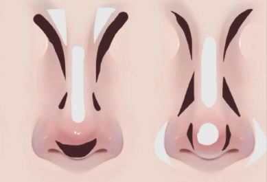 廣西習(xí)化妝排名：不同鼻型如何修容？